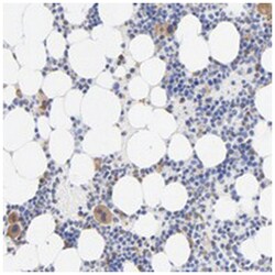 TAGLN2, Rabbit, Polyclonal Antibody, Abnova 100 &mu;L | Buy Online | Abnova Corporation | Fisher Scientific