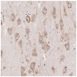 PREX1, Rabbit, Polyclonal Antibody, Abnova 100&mu;L; Unlabeled:Antibodies,