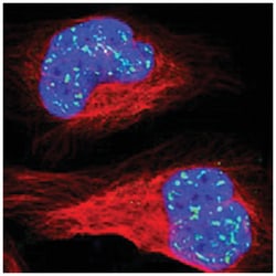 MBD4 Rabbit anti-Human, Polyclonal Antibody, Abnova 100&mu;L; Unlabeled:Antibodies,