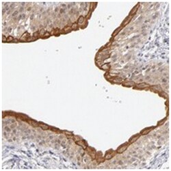 C14orf135 Rabbit anti-Human, Polyclonal Antibody, Abnova 100 &mu;L | Buy Online | Abnova Corporation | Fisher Scientific