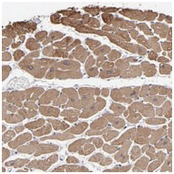 CCDC80, Rabbit, Polyclonal Antibody, Abnova 100&mu;L; Unlabeled:Antibodies,