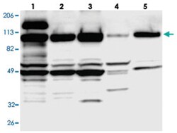 SMEK1, Rabbit, Polyclonal Antibody, Abnova 100&mu;L; Unlabeled:Antibodies,