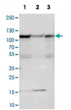 SMEK1, Rabbit, Polyclonal Antibody, Abnova 100&mu;L; Unlabeled:Antibodies,