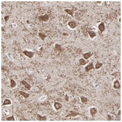 SLC22A17 Rabbit anti-Human, Polyclonal Antibody, Abnova 100 &mu;L | Buy Online | Abnova Corporation | Fisher Scientific