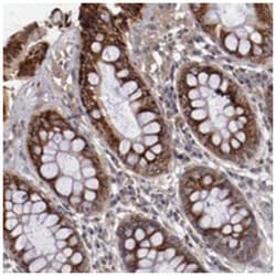 CXorf36, Rabbit, Polyclonal Antibody, Abnova 100&mu;L; Unlabeled:Antibodies,