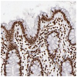 FBXO18, Rabbit, Polyclonal Antibody, Abnova 100&mu;L; Unlabeled:Antibodies,