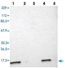 ATP5D Rabbit anti-Human, Mouse, Rat, Polyclonal Antibody, Abnova 100&mu;L;
