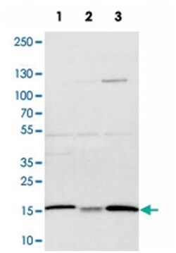 ATP5D Rabbit anti-Human, Mouse, Rat, Polyclonal Antibody, Abnova 100&mu;L;