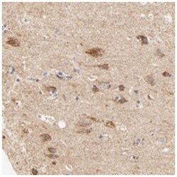 ATP5D Rabbit anti-Human, Mouse, Rat, Polyclonal Antibody, Abnova 100&mu;L;