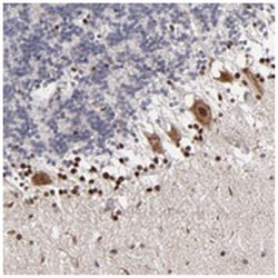 NPAS3 Rabbit anti-Human, Polyclonal Antibody, Abnova 100 &mu;L | Buy Online | Abnova Corporation | Fisher Scientific