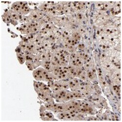 EAPP, Rabbit, Polyclonal Antibody, Abnova 100 &mu;L | Buy Online | Abnova Corporation | Fisher Scientific
