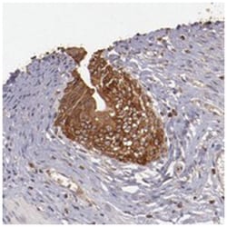 SRRD, Rabbit, Polyclonal Antibody, Abnova 100&mu;L; Unlabeled:Anticorps,