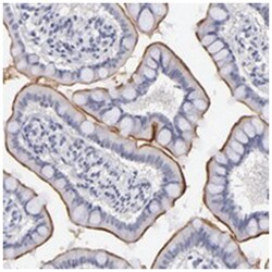 TEX11, Rabbit, Polyclonal Antibody, Abnova 100&mu;L; Unlabeled:Antibodies,