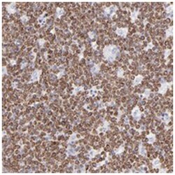 LRMP Rabbit anti-Human, Polyclonal Antibody, Abnova 100&mu;L; Unlabeled:Antibodies,