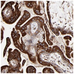 ELP2 Rabbit anti-Human, Polyclonal Antibody, Abnova 100&mu;L; Unlabeled:Antibodies,