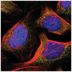 ELP2 Rabbit anti-Human, Polyclonal Antibody, Abnova 100&mu;L; Unlabeled:Antibodies,