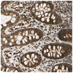C11orf59, Rabbit, Polyclonal Antibody, Abnova 100 &mu;L | Buy Online | Abnova Corporation | Fisher Scientific