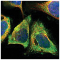 C11orf59, Rabbit, Polyclonal Antibody, Abnova 100 &mu;L | Buy Online | Abnova Corporation | Fisher Scientific