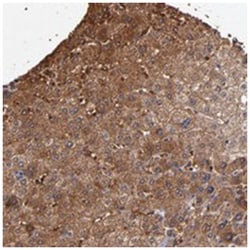 MLC1 Rabbit anti-Human, Polyclonal Antibody, Abnova 100 &mu;L | Buy Online | Abnova Corporation | Fisher Scientific