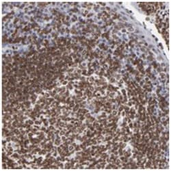 THAP7, Rabbit, Polyclonal Antibody, Abnova 100 &mu;L | Buy Online | Abnova Corporation | Fisher Scientific