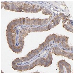 STON2, Rabbit, Polyclonal Antibody, Abnova 100&mu;L; Unlabeled:Antibodies,