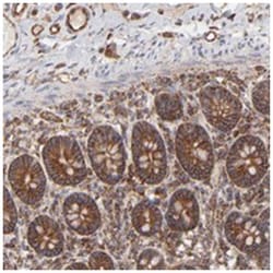 COX8C, Rabbit, Polyclonal Antibody, Abnova 100 &mu;L | Buy Online | Abnova Corporation | Fisher Scientific