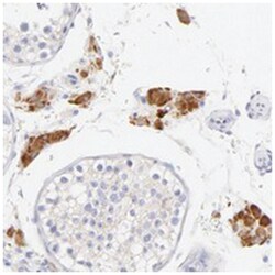 EBP, Rabbit, Polyclonal Antibody, Abnova 100&mu;L; Unlabeled:Antibodies,