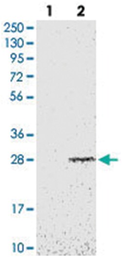EBP, Rabbit, Polyclonal Antibody, Abnova 100&mu;L; Unlabeled:Antibodies,