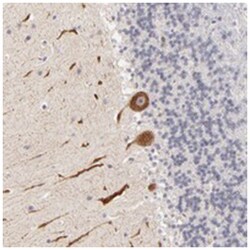 ZNF559-ZNF177, Rabbit, Polyclonal Antibody, Abnova 100&mu;L; Unlabeled:Antibodies,