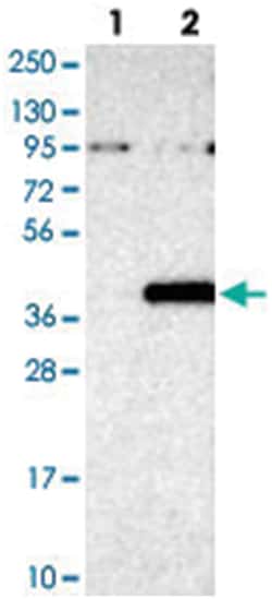 ZNF559-ZNF177, Rabbit, Polyclonal Antibody, Abnova 100&mu;L; Unlabeled:Antibodies,
