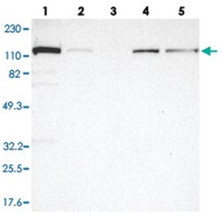 KTN1 Rabbit anti-Human, Polyclonal Antibody, Abnova 100&mu;L; Unlabeled:Antibodies,