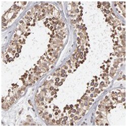 KTN1 Rabbit anti-Human, Polyclonal Antibody, Abnova 100&mu;L; Unlabeled:Antibodies,