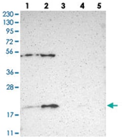 APOO, Rabbit, Polyclonal Antibody, Abnova 100&mu;L; Unlabeled:Antibodies,