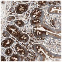 APOO, Rabbit, Polyclonal Antibody, Abnova 100&mu;L; Unlabeled:Antibodies,