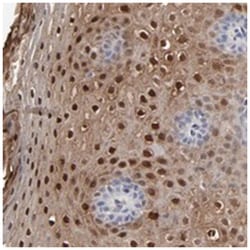 SLC6A14, Rabbit, Polyclonal Antibody, Abnova 100 &mu;L | Buy Online | Abnova Corporation | Fisher Scientific