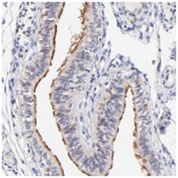 RIBC2, Rabbit, Polyclonal Antibody, Abnova 100 &mu;L | Buy Online | Abnova Corporation | Fisher Scientific