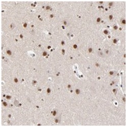 ZMYM3 Rabbit anti-Human, Polyclonal Antibody, Abnova 100&mu;L; Unlabeled:Antibodies,