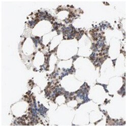 DOCK8, Rabbit, Polyclonal Antibody, Abnova 100 &mu;L | Buy Online | Abnova Corporation | Fisher Scientific