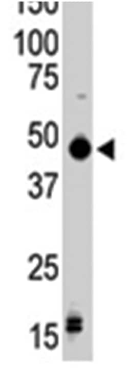 PRKAR1B, Rabbit, Polyclonal Antibody, Abnova 400 &mu;L | Buy Online | Abnova Corporation | Fisher Scientific