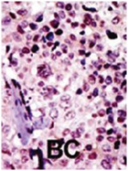 PRKAR1B, Rabbit, Polyclonal Antibody, Abnova 400 &mu;L | Buy Online | Abnova Corporation | Fisher Scientific