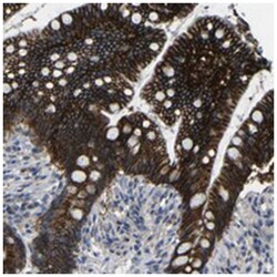 ZNF90, Rabbit, Polyclonal Antibody, Abnova 100 &mu;L | Buy Online | Abnova | Fisher Scientific