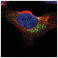 ZNF90, Rabbit, Polyclonal Antibody, Abnova 100 &mu;L | Buy Online | Abnova | Fisher Scientific