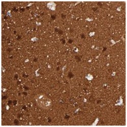 FAM117B, Rabbit, Polyclonal Antibody, Abnova 100 &mu;L | Buy Online | Abnova Corporation | Fisher Scientific