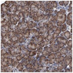 CHM, Rabbit, Polyclonal Antibody, Abnova 100&mu;L; Unlabeled:Antibodies,