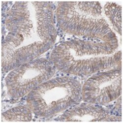 LRCH2, Rabbit, Polyclonal Antibody, Abnova 100 &mu;L | Buy Online | Abnova Corporation | Fisher Scientific