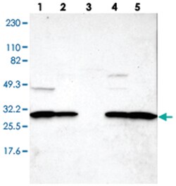 ZCCHC16, Rabbit, Polyclonal Antibody, Abnova 100 &mu;L | Buy Online | Abnova Corporation | Fisher Scientific