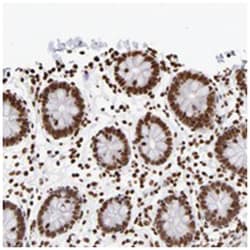 ZCCHC16, Rabbit, Polyclonal Antibody, Abnova 100 &mu;L | Buy Online | Abnova Corporation | Fisher Scientific