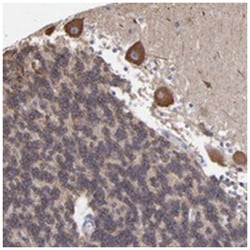 RBM44, Rabbit, Polyclonal Antibody, Abnova 100 &mu;L | Buy Online | Abnova Corporation | Fisher Scientific