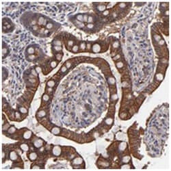 ZNF780B, Rabbit, Polyclonal Antibody, Abnova 100 &mu;L | Buy Online | Abnova Corporation | Fisher Scientific