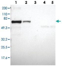 CD2AP Rabbit anti-Human, Mouse, Rat, Polyclonal Antibody, Abnova 100 &mu;L | Buy Online | Abnova Corporation | Fisher Scientific